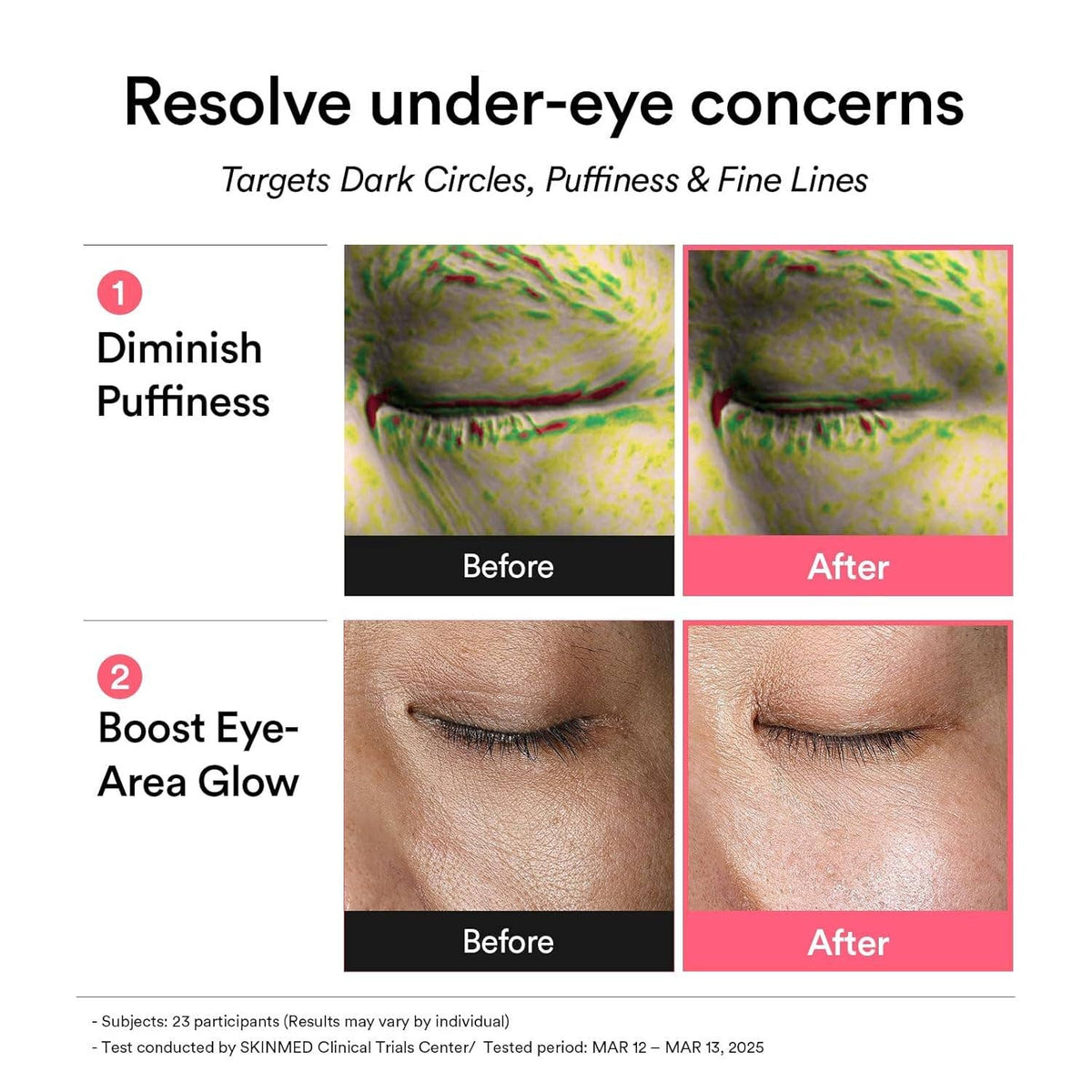 Abib PDRN Retinal Eye Patches for Rejuvenating & Puffy Eyes